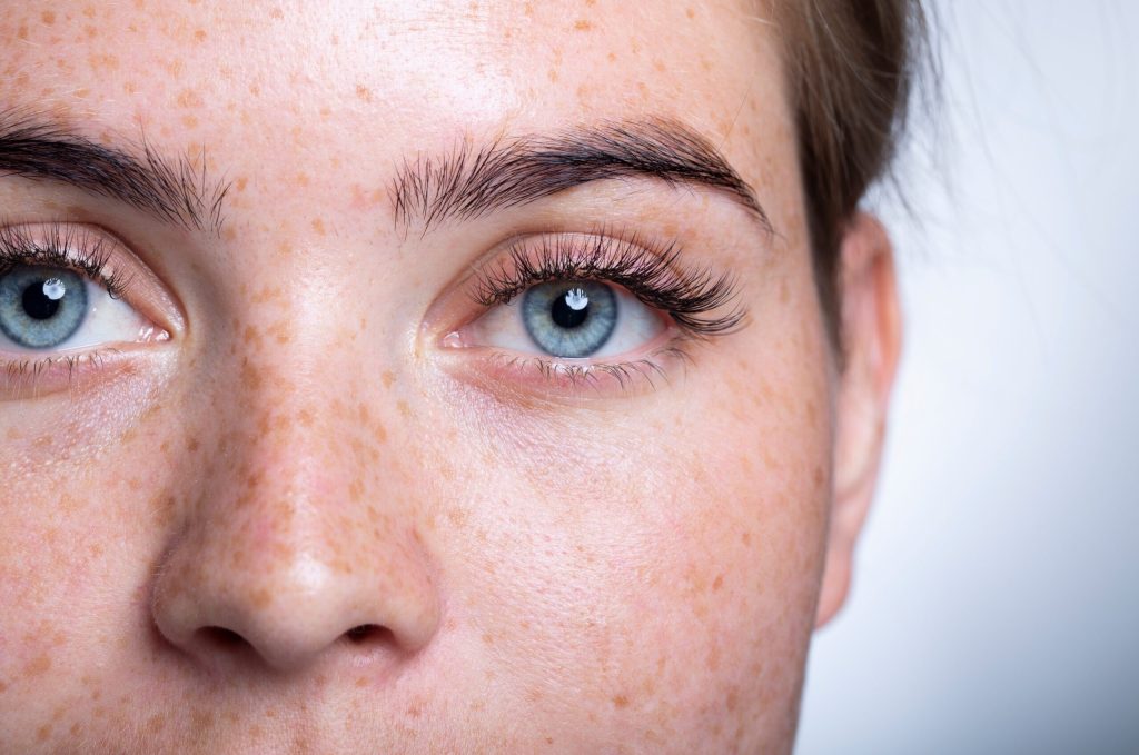 Experts have shared what to do if you have eye ‘floaters’